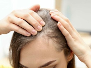 dallas-hair-loss-solutions