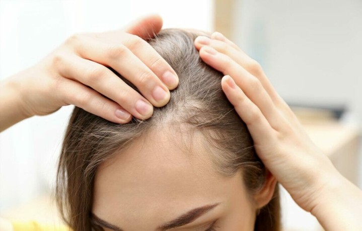 dallas-hair-loss-solutions-big-0