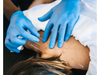 Dry Needling Therapy NYC