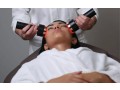laser-for-melasma-clermont-small-0