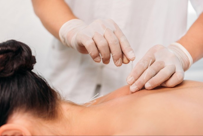 dry-needling-nyc-big-0