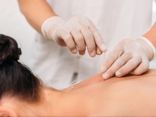 dry-needling-nyc