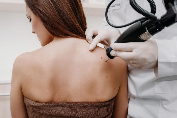 fractionated-co2-laser-for-acne-scars-pigmentation-in-altamonte-springs-orlando-daytona-beach-clermont-big-0