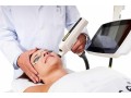 lasers-hair-removal-clinic-candela-gentlemax-pro-altamonte-springs-orlando-daytona-beach-clermont-small-0